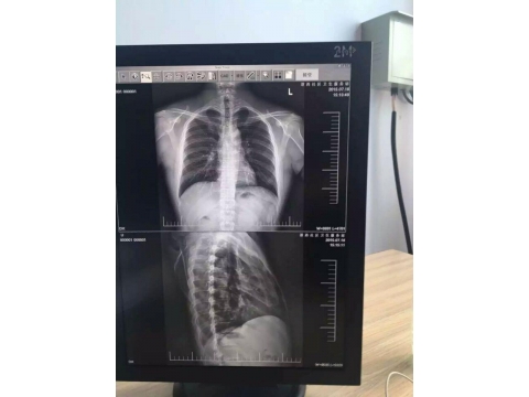 27寸醫(yī)療顯示器